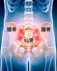 意外と知らない仙腸関節炎の痛み | 春日部市ケアメディカル鍼灸整骨院